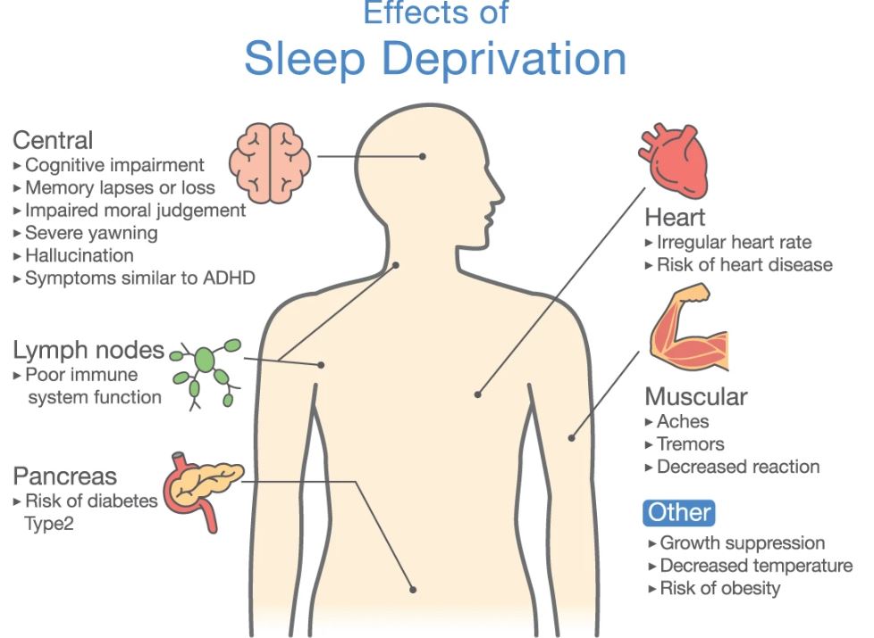 Sleep deprivation and poor sleep quality.